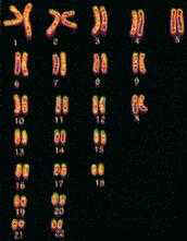 chromosome